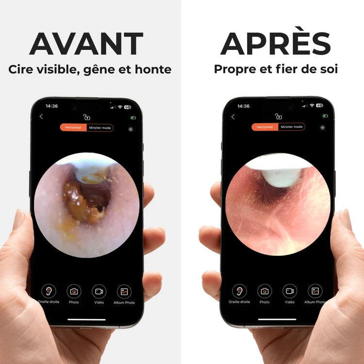 ICON VISION 1.0 – HYGIÈNE AUDITIVE RÉVOLUTIONNÉE